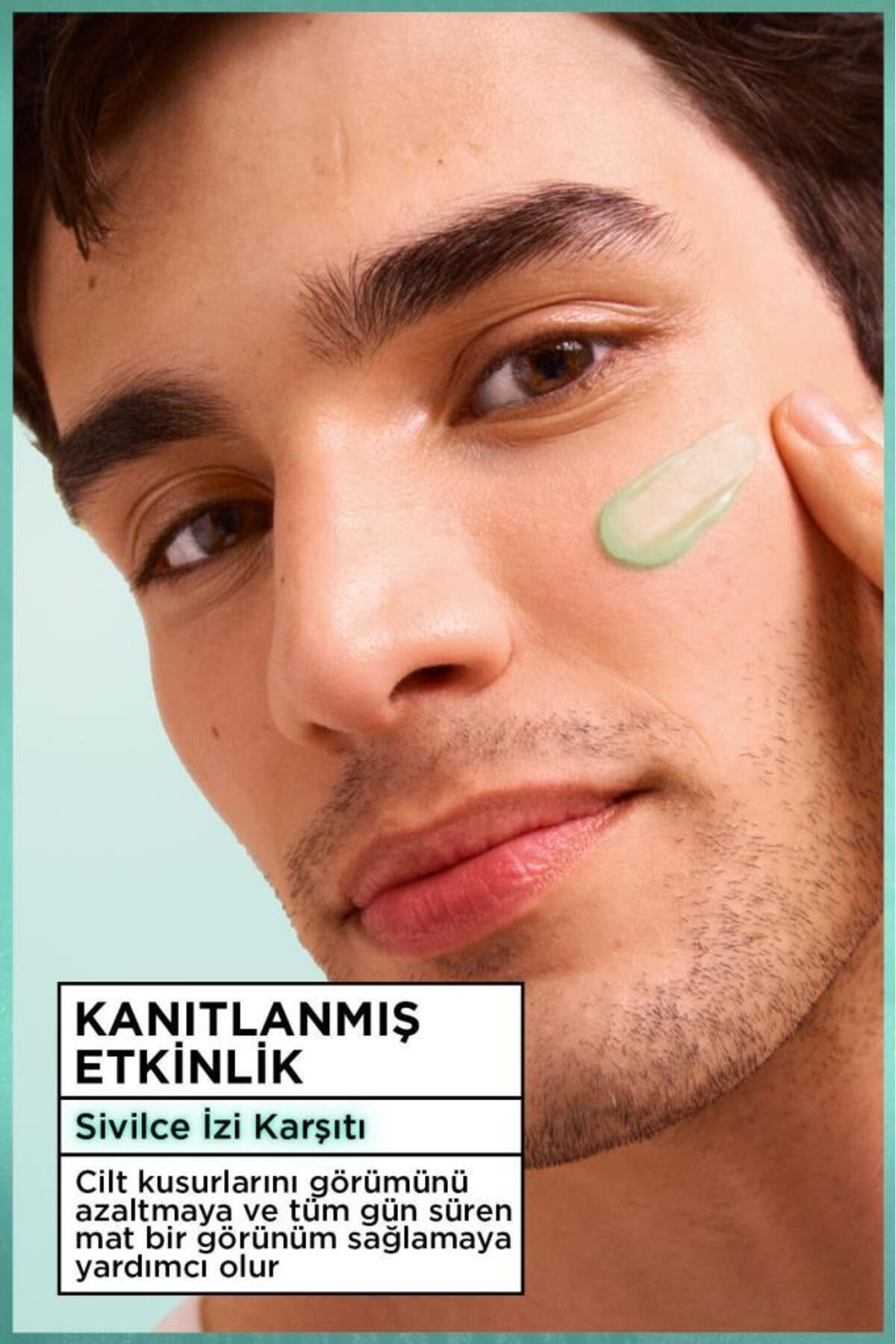 Garnier Salisilik Fresh & Matte SİVİLCE İzi Karşıtı Nemlendirici Sorbe Yüz Kremi 85 ML, Vegan 4