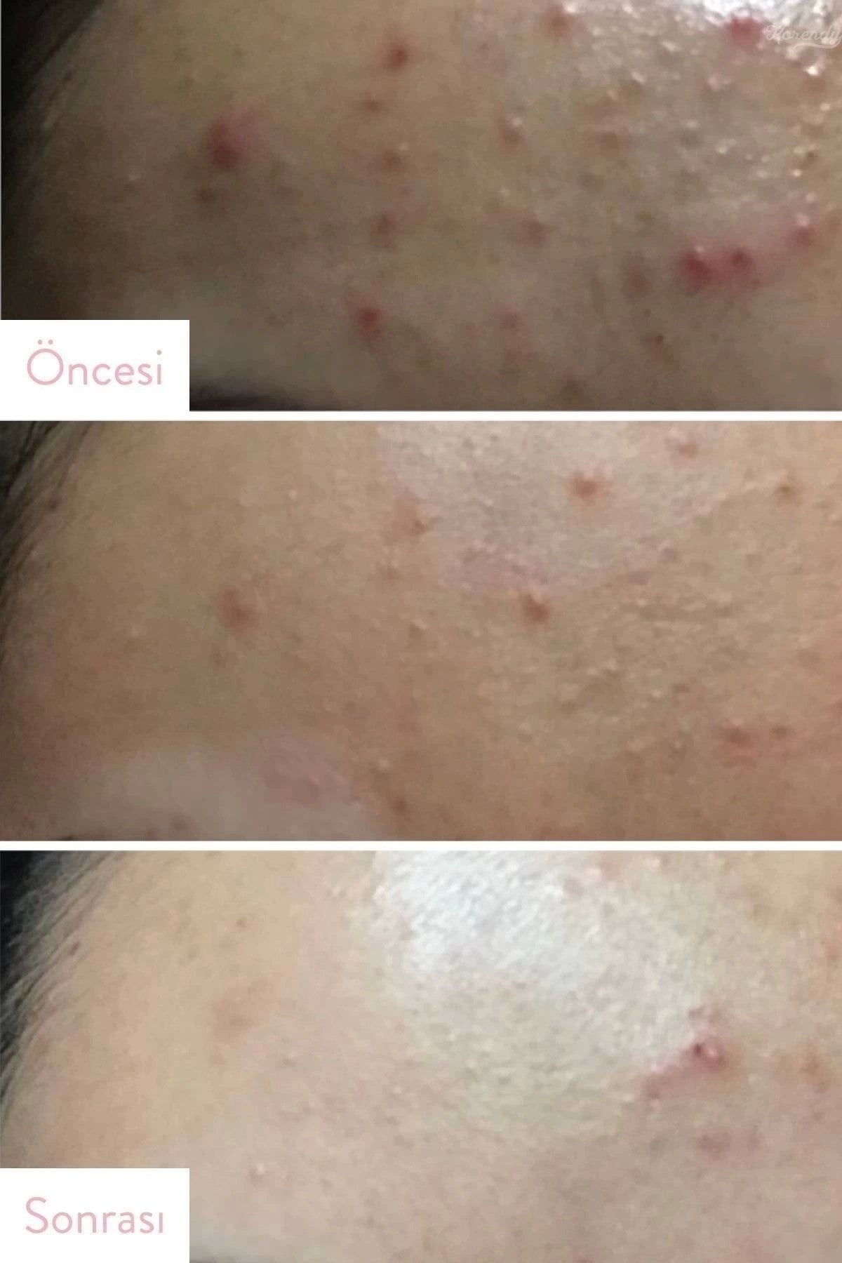 Aha Bha Pha 30 Days Miracle Serum (KORENDY) Yatıştırıcı Aydınlatıcı Serum 50 ml