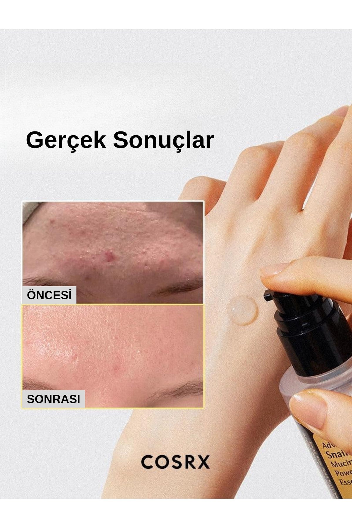 Advanced Snail 96 Mucin Power Essence 100ml - Salyangoz Özlü Nemlendirici ve Besleyici Esans